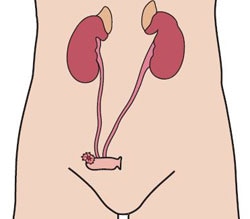 Urostoma Urostoma